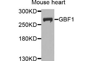 Western blot analysis of extracts of mouse heart, using GBF1 antibody. (GBF1 抗体)