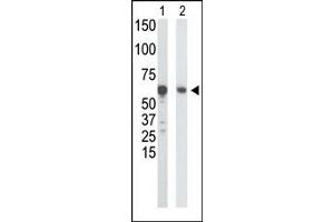 Western Blotting (WB) image for anti-Glucokinase (Hexokinase 4) (GCK) (N-Term) antibody (ABIN5552277) (GCK 抗体  (N-Term))
