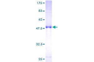 RAB17 Protein (AA 1-212) (GST tag)