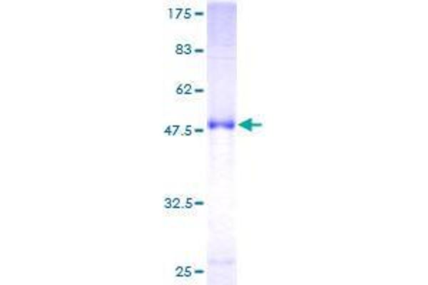 RAB17 Protein (AA 1-212) (GST tag)