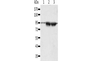 Gel: 10 % SDS-PAGE, Lysate: 60 μg, Lane 1-3: A549 cells, lncap cells, human seminoma tissue, Primary antibody: ABIN7192627(SPATA20 Antibody) at dilution 1/1000, Secondary antibody: Goat anti rabbit IgG at 1/8000 dilution, Exposure time: 5 minutes (SPATA2 抗体)