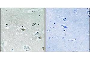 Immunohistochemistry analysis of paraffin-embedded human brain, using SREBP-1 (Phospho-Ser439) Antibody. (SREBF1 抗体  (pSer439))