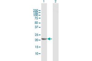Western Blot analysis of RPE expression in transfected 293T cell line by RPE MaxPab polyclonal antibody.