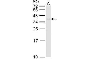 WB Image Sample (30 ug of whole cell lysate) A: H1299 12% SDS PAGE antibody diluted at 1:1000 (HLA-DR 抗体  (Center))