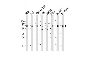 All lanes : Anti-IGF2BP1 Antibody (C-term) at 1:2000 dilution Lane 1: 293 whole cell lysate Lane 2: RD whole cell lysate Lane 3: Karpas 299 whole cell lysate Lane 4: Raji whole cell lysate Lane 5: Jurkat whole cell lysate Lane 6: Hela whole cell lysate Lane 7: HepG2 whole cell lysate Lane 8: NIH/3T3 whole cell lysate Lysates/proteins at 20 μg per lane. (IGF2BP1 抗体  (C-Term))