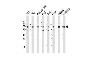 IGF2BP1 抗体  (C-Term)