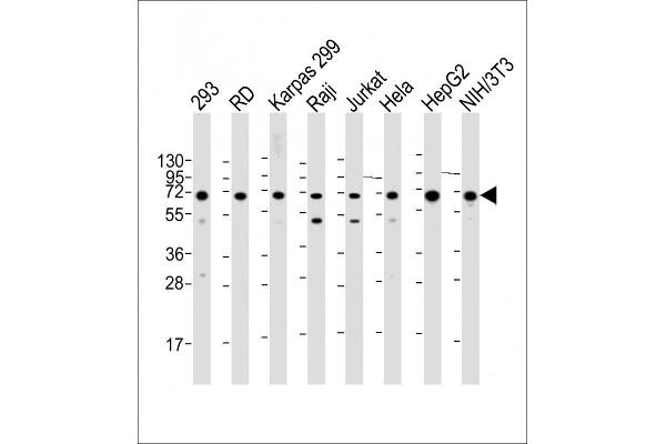 IGF2BP1 antibody  (C-Term)