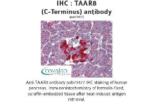 Image no. 1 for anti-Trace Amine Associated Receptor 8 (TAAR8) (C-Term) antibody (ABIN1739866) (Trace Amine Associated Receptor 8 (TAAR8) (C-Term) 抗体)