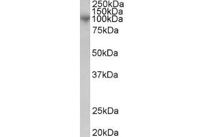 Western Blotting (WB) image for anti-ADAM Metallopeptidase Domain 8 (ADAM8) antibody (ABIN5911617) (ADAM8 抗体)