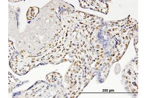 Immunoperoxidase of monoclonal antibody to RUNX2 on formalin-fixed paraffin-embedded human placenta. (RUNX2 抗体  (AA 251-350))