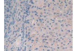 Detection of SYN1 in Mouse Ovary Tissue using Polyclonal Antibody to Synapsin I (SYN1) (SYN1 抗体  (AA 113-420))