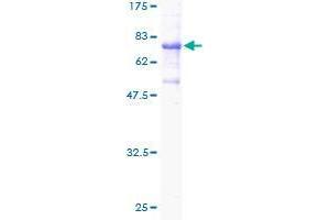 ECSIT Protein (ECSIT) (AA 20-431) (GST tag)
