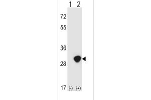 Western blot analysis of TPI1 (arrow) using rabbit polyclonal TPI1 Antibody (N-term) (ABIN389457 and ABIN2839524). (TPI1 抗体  (N-Term))