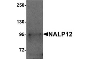 Western blot analysis of NALP12 in human brain tissue lysate with NALP12 antibody at 1 μg/ml.
