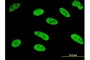 Immunofluorescence of monoclonal antibody to MEF2A on HeLa cell. (MEF2A 抗体  (AA 71-170))