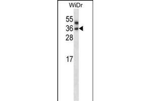 PNPLA4 Antibody (C-term) (ABIN657892 and ABIN2846844) western blot analysis in WiDr cell line lysates (35 μg/lane). (PNPLA4 抗体  (C-Term))