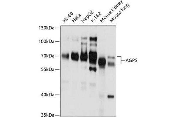 AGPS anticorps  (AA 379-658)