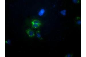 Anti-CALCOCO2 mouse monoclonal antibody (ABIN2453920) immunofluorescent staining of COS7 cells transiently transfected by pCMV6-ENTRY CALCOCO2 (RC203843). (CALCOCO2 抗体)