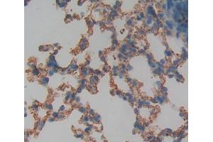 Immunohistochemistry (IHC) image for anti-Protein Phosphatase 1, Regulatory (Inhibitor) Subunit 15A (PPP1R15A) (AA 433-636), (Regulatory Subunit 15A) antibody (ABIN5014190)