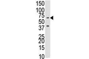 Western Blotting (WB) image for anti-Bone Morphogenetic Protein Receptor, Type IB (BMPR1B) (AA 1-30) antibody (ABIN3030190)