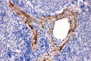 Anti-ADAM19 antibody, IHC(P) IHC(P): Rat Spleen Tissue (ADAM19 抗体  (N-Term))