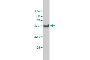 Western Blotting (WB) image for anti-Carbonic Anhydrase III (CA3) (AA 1-260) antibody (ABIN560131)