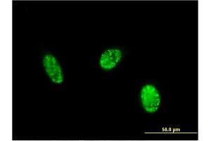 Immunofluorescence of monoclonal antibody to EXOSC1 on HeLa cell. (EXOSC1 抗体  (AA 1-195))