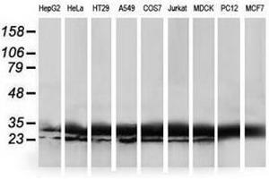 Image no. 3 for anti-Haloacid Dehalogenase-Like Hydrolase Domain Containing 1 (HDHD1) antibody (ABIN1498622) (HDHD1 抗体)