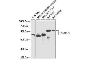 Western blot analysis of extracts of various cell lines using ADRA2B Polyclonal Antibody at dilution of 1:1000. (ADRA2B 抗体)