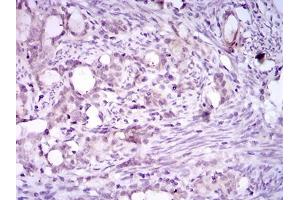 Immunohistochemistry (IHC) image for anti-Integrin Alpha2b (CD41) (AA 45-149) antibody (ABIN1724822)