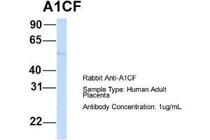Host:  Rabbit  Target Name:  A1CF  Sample Type:  Human Adult Placenta  Antibody Dilution:  1.