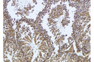 ABIN6276964 at 1/100 staining Mouse testis tissue by IHC-P. (GPX4 抗体  (C-Term))