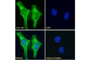ABIN6391361 Immunofluorescence analysis of paraformaldehyde fixed HeLa cells, permeabilized with 0. (Sonic Hedgehog 抗体  (C-Term))