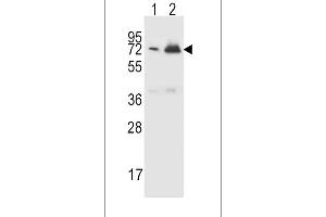 Western blot analysis in CEM(lane 1),K562(lane 2) cell line lysates (15ug/lane). (CFHR5 抗体  (AA 203-231))