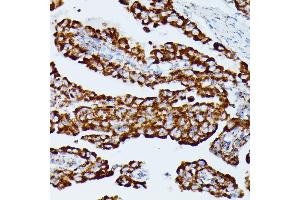 Immunohistochemistry (IHC) image for anti-Isocitrate Dehydrogenase 3 (NAD+) alpha (IDH3A) (AA 28-366) antibody (ABIN7268029)