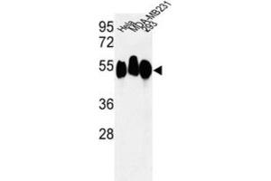 Western Blotting (WB) image for anti-Retinoblastoma Binding Protein 7 (RBBP7) antibody (ABIN3003931) (RBBP7 抗体)