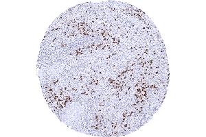 Spleen S100A12 immunostaining is seen in granulocytes of mainly the red pulp. (S100A12 抗体)