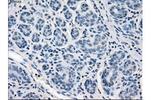 Immunohistochemical staining of paraffin-embedded breast tissue using anti-SLC2A5 mouse monoclonal antibody. (SLC2A5 抗体)