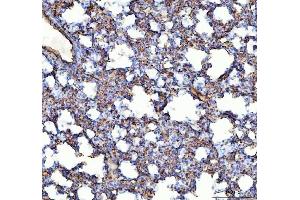 IHC analysis of ACE using anti-ACE antibody (ABIN3043777). (Angiotensin I Converting Enzyme 1 抗体  (AA 651-864))