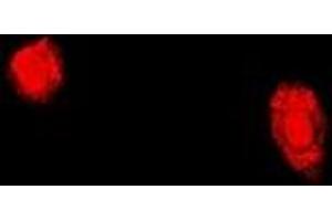 Immunofluorescent analysis of TPP2 staining in U2OS cells. (Tpp2 抗体)