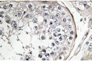 Image no. 1 for anti-Phosphoinositide 3 Kinase, p85 alpha (PI3K p85a) antibody (ABIN317803) (PIK3R1 抗体)
