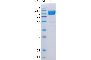 Human AXL Protein, hFc Tag on SDS-PAGE under reducing condition.