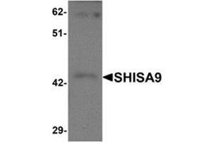 Western blot analysis of SHISA9 in rat brain tissue lysate with SHISA9 antibody at 1 μg/ml. (Shisa9 抗体  (Center))