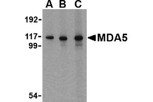 Western blot analysis of MDA5 in Daudi cell lysate with MDA5 antibody at (A) 1, (B) 2 and (C) 4 µg/mL. (IFIH1 抗体  (C-Term))