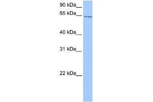 WB Suggested Anti-C2orf42 Antibody Titration: 0. (C2orf42 抗体  (C-Term))