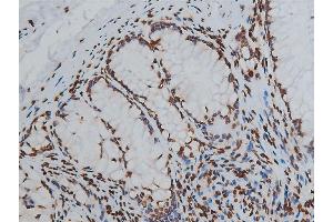 ABIN6254904 and ABIN6267568 at 1/200 staining human colon tissue sections by IHC-P.