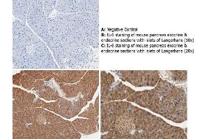 Immunohistochemistry (IHC) image for anti-Interleukin 6 (IL6) antibody (ABIN964780)