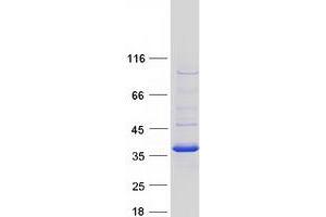 Western Blotting (WB) image for Carbonyl Reductase 3 (CBR3) protein (Myc-DYKDDDDK Tag) (ABIN2713141)
