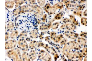 Immunohistochemistry (Paraffin-embedded Sections) (IHC (p)) image for anti-Heat Shock 70kDa Protein 8 (HSPA8) (AA 520-614) antibody (ABIN3043852)