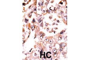 Immunohistochemistry (IHC) image for anti-Dual Specificity Phosphatase 3 (DUSP3) antibody (ABIN3003774) (Dual Specificity Phosphatase 3 (DUSP3) 抗体)